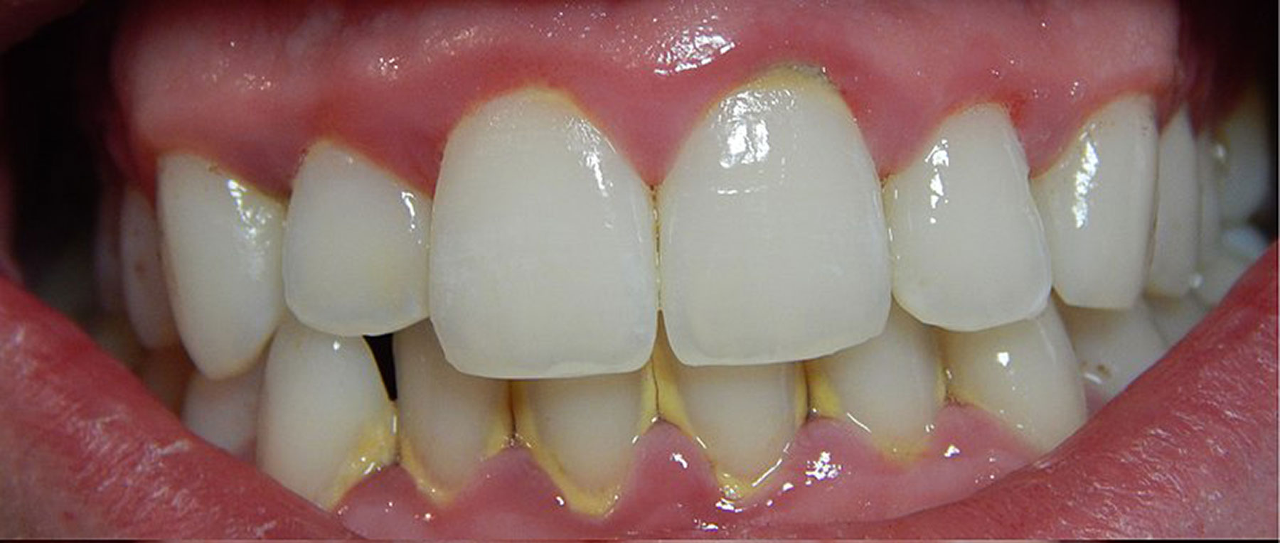 aldente dentistry