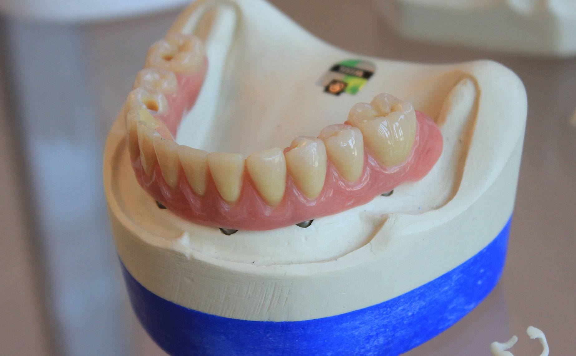 teeth-last-long2