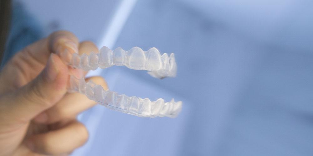 Cleaning Your Invisalign Trays (Our Best Tips And Tricks!) - Dr. Kim  Okamura DDS