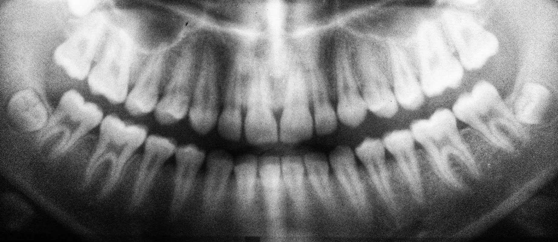 dental -x-ray
