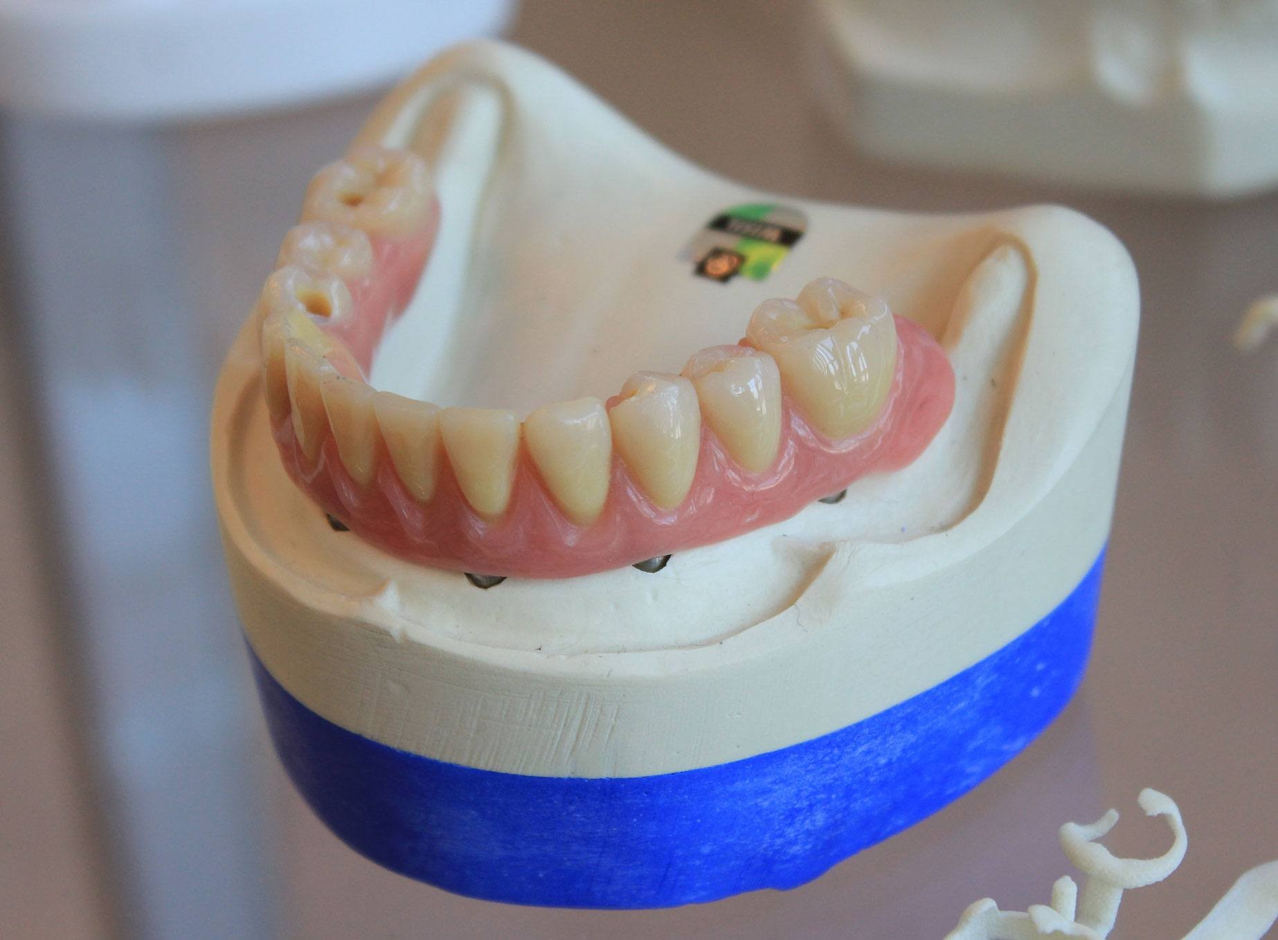taking-care-of-gums2